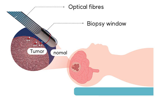 Fiber Endoscopy